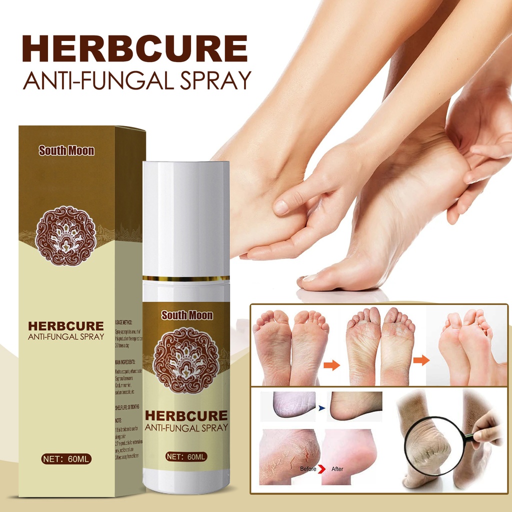 Herbcure Anti-Fungal Spray